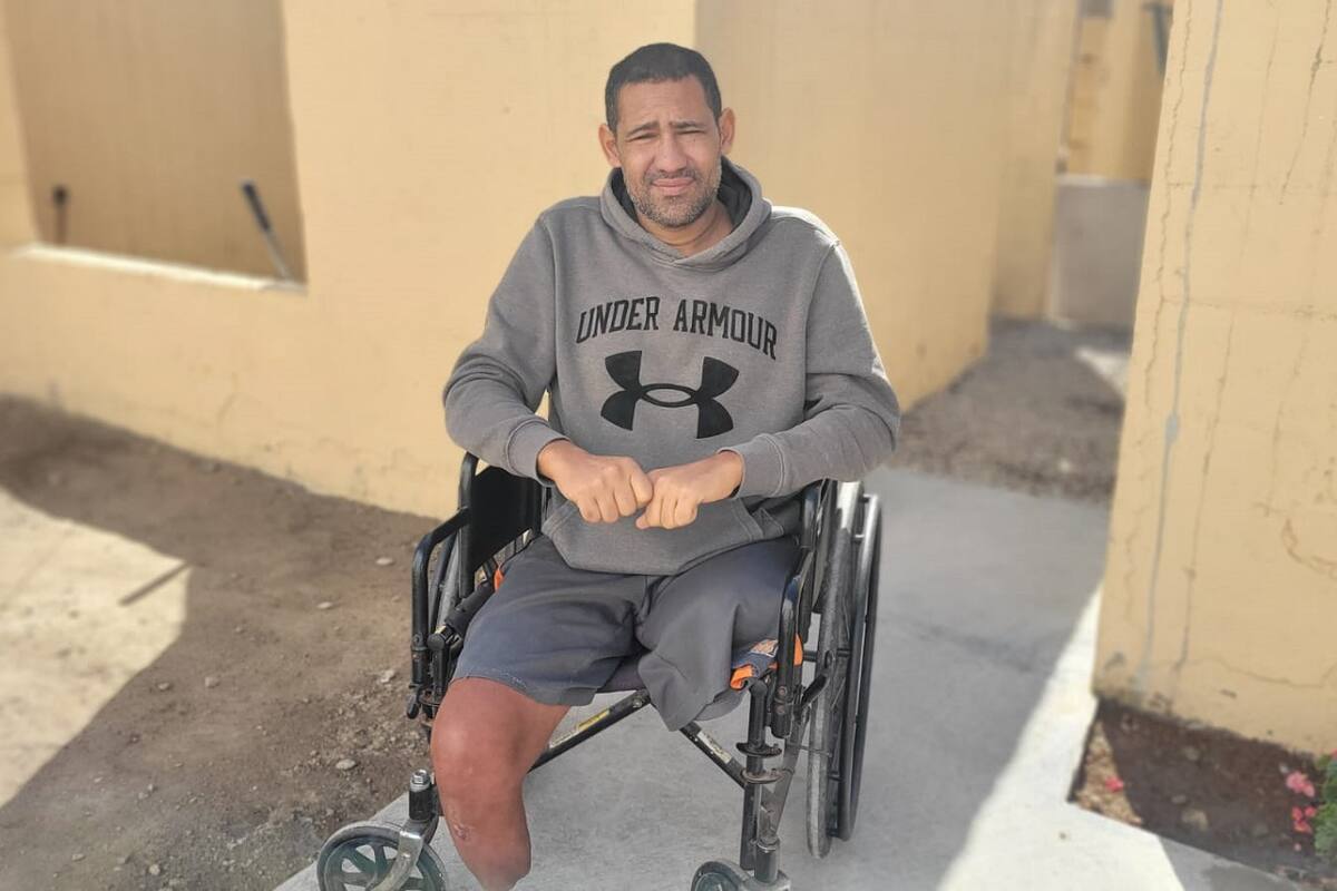 Le roban a migrante de Venezuela prótesis de pierna en Tijuana; pide apoyo