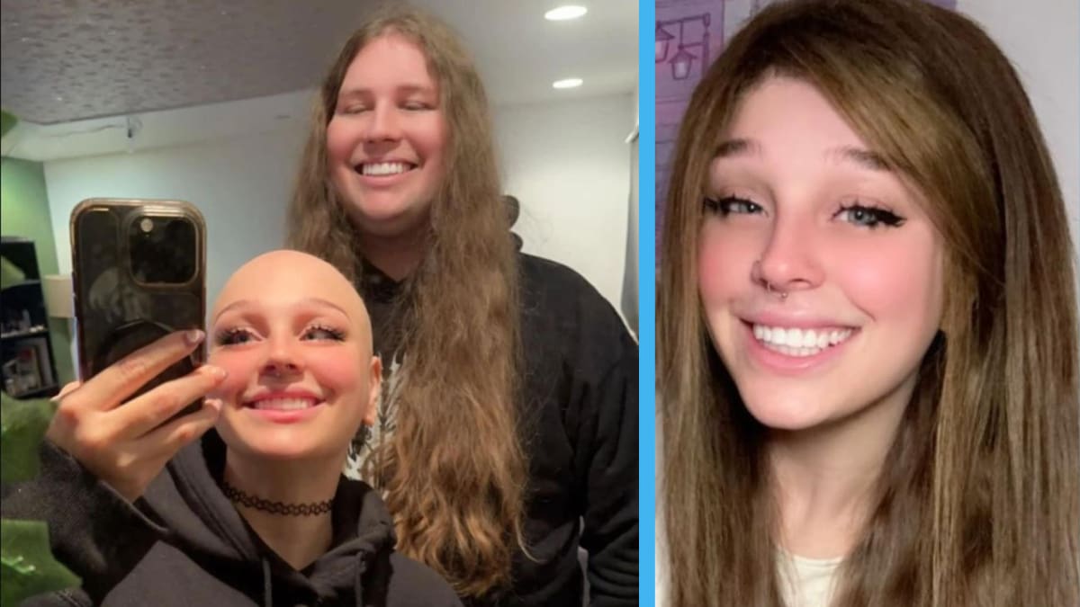 Novio convierte su cabello en una peluca para su pareja con alopecia y emociona a internet