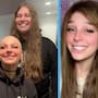 Novio convierte su cabello en una peluca para su pareja con alopecia y emociona a internet