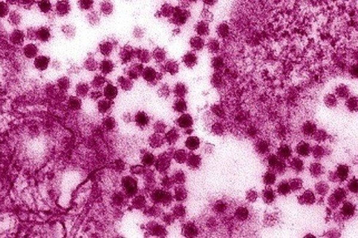 Hay riesgo de que el Virus del Nilo Occidental llegue a Baja California