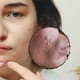 Cicatrices del acné en la cara: Esto es lo que recomienda la IA y los expertos en la piel