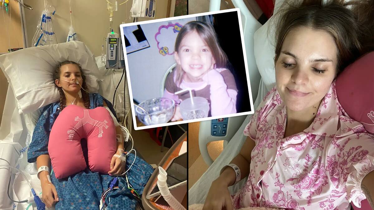 Tras ser llamada “dramática” toda su infancia por evitar subir escaleras, a los 16 años fue diagnosticada con hipertensión pulmonar: La historia de Marina Jones