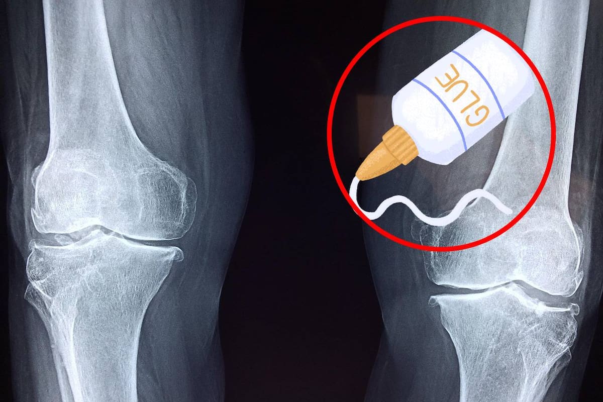 Según un informe, científicos chinos crean un pegamento óseo para reparar fracturas en minutos