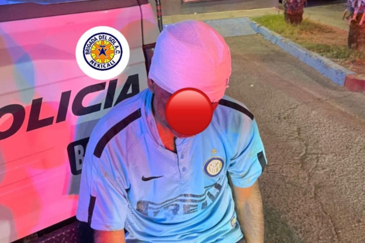 Hombre es golpeado con un bate y sufre amputación parcial de un dedo