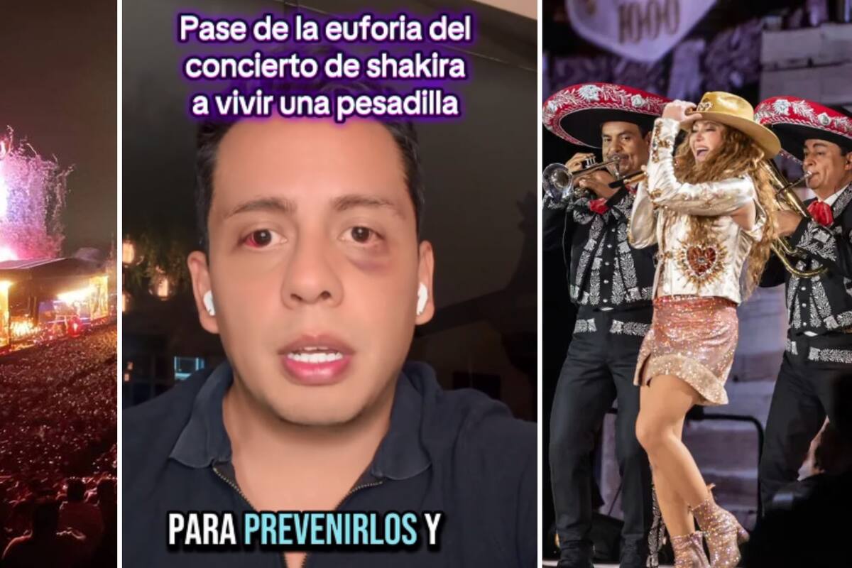 Fan de Shakira podría perser la vista tras ser secuestrado y golpeado saliendo de concierto en CDMX