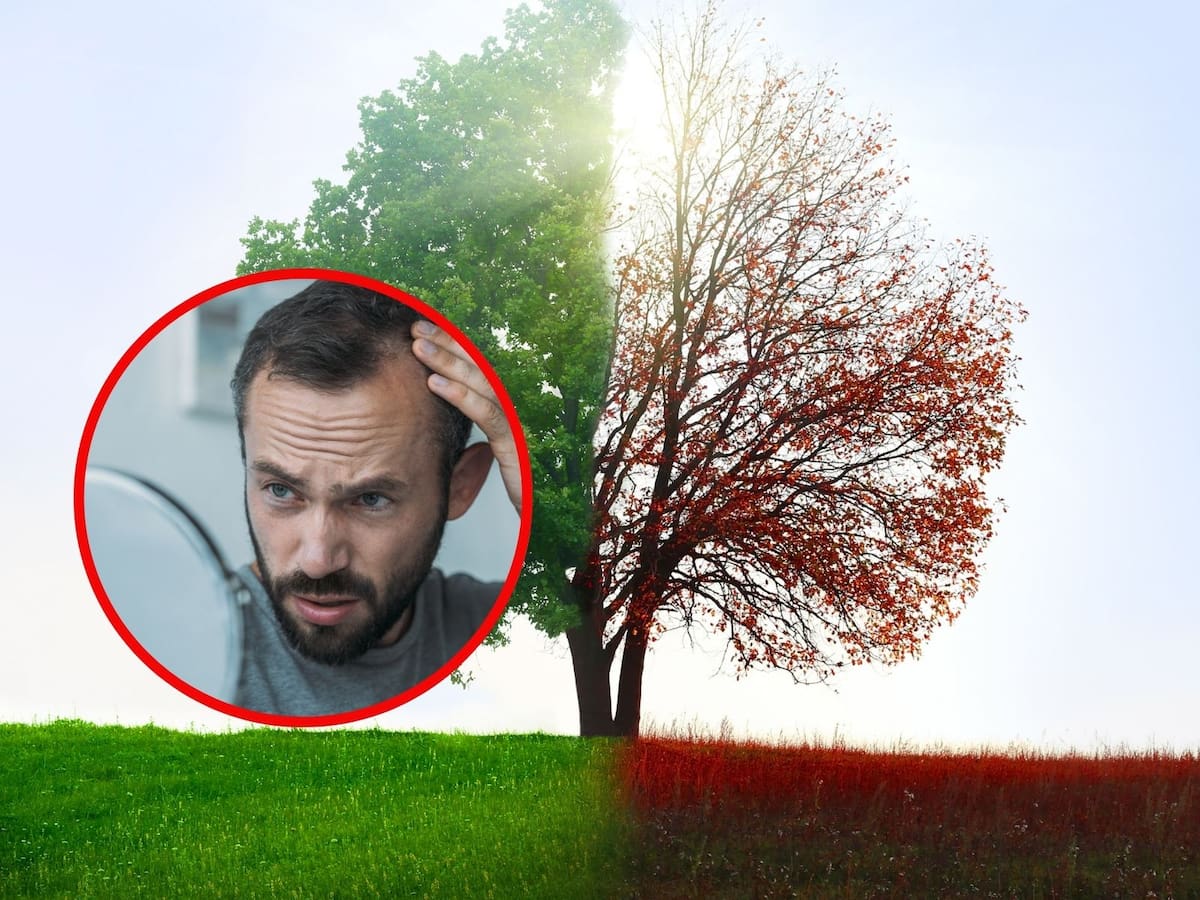 Las temperaturas de otoño y verano incrementan la caída de cabello, según un estudio. | Crédito: Canva