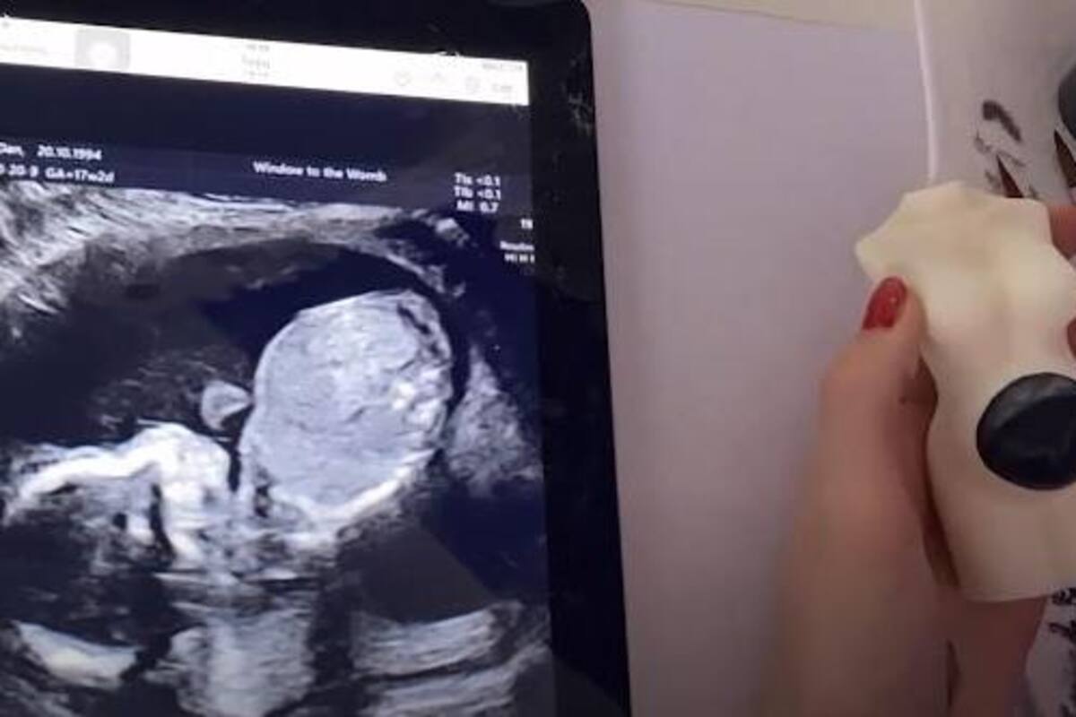Joven artista pinta ultrasonidos en unas velas y se hace viral
