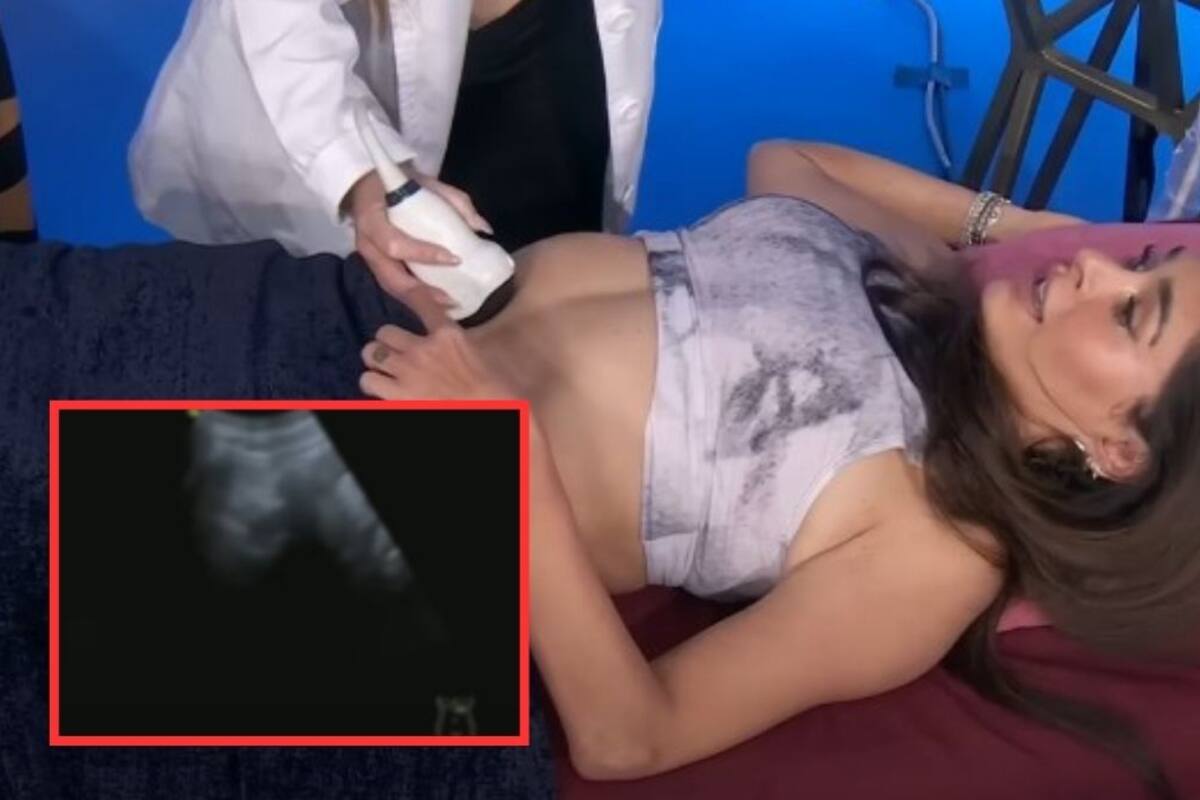 Galilea Montijo se hace un ultrasonido en vivo en el programa “Hoy” ¿Está embarazada?