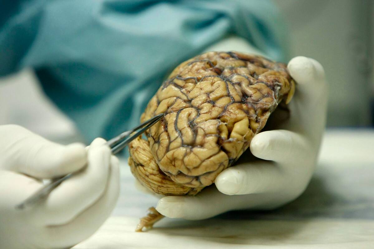 Un estudio identifica un área del cerebro que responde a las amenazas