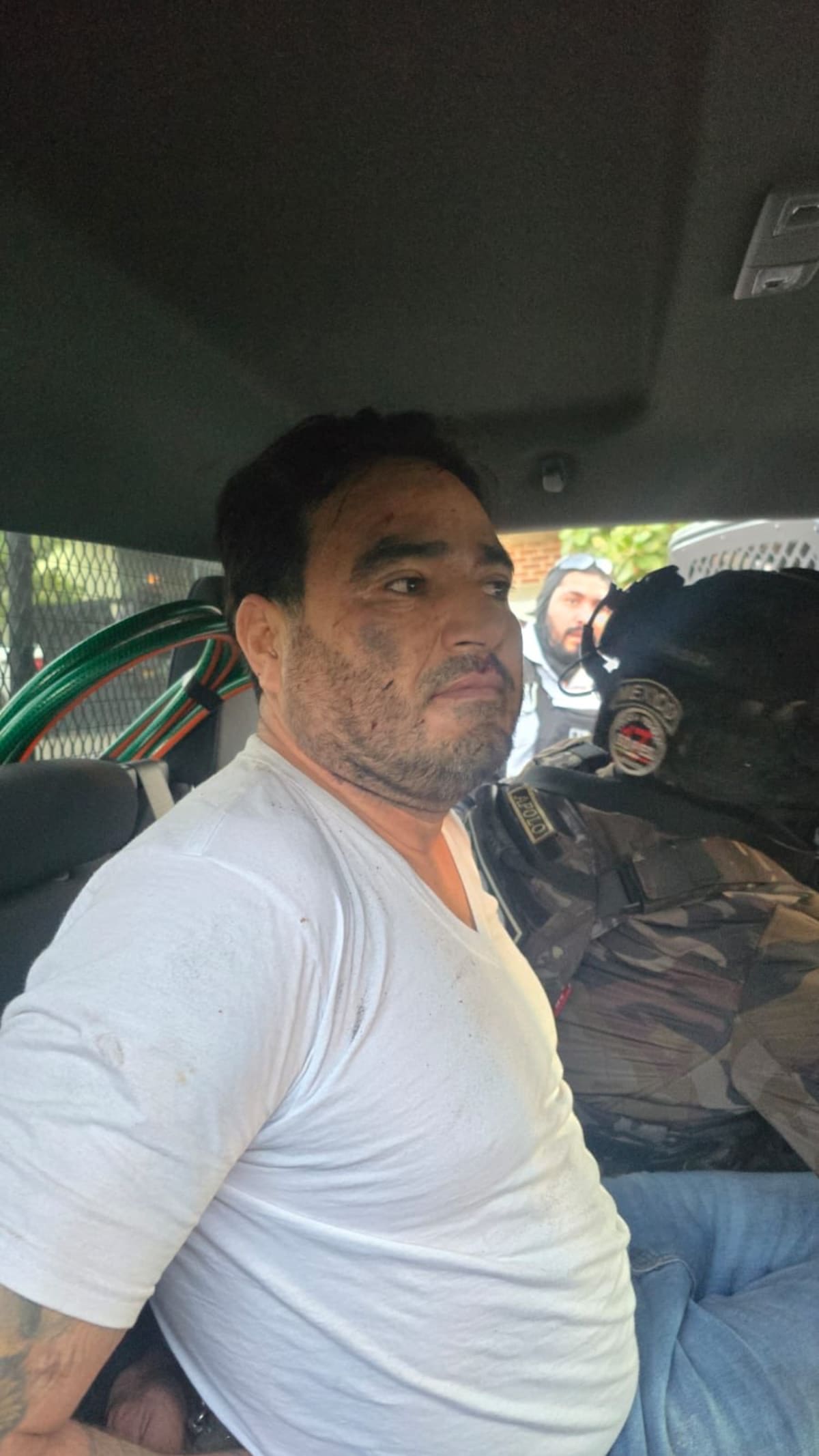 “El Botox”. (OHarfuch)