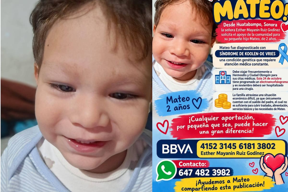 Mamá de Huatabampo pide apoyo para viajar a Hermosillo y continuar el tratamiento de su hijo de 2 años con síndrome de Koolen de Vries