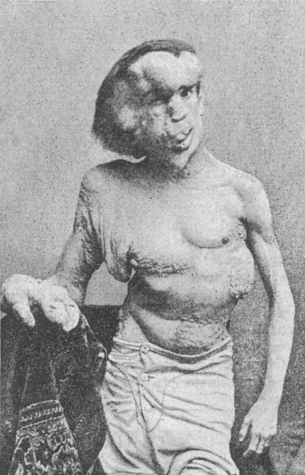 Imagen tomada de Wikipedia