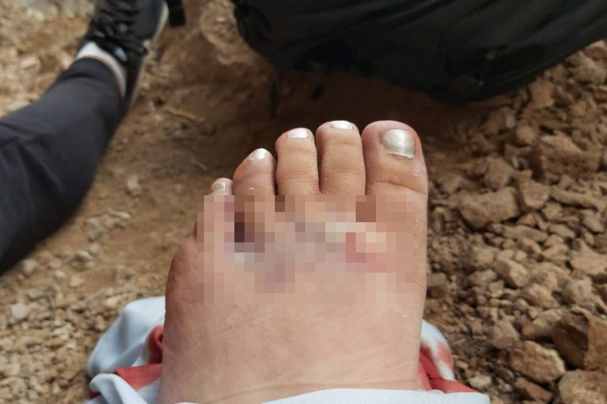 Cajemense se accidenta en cerro Tetakawi; sufre varias lesiones y fractura de pie