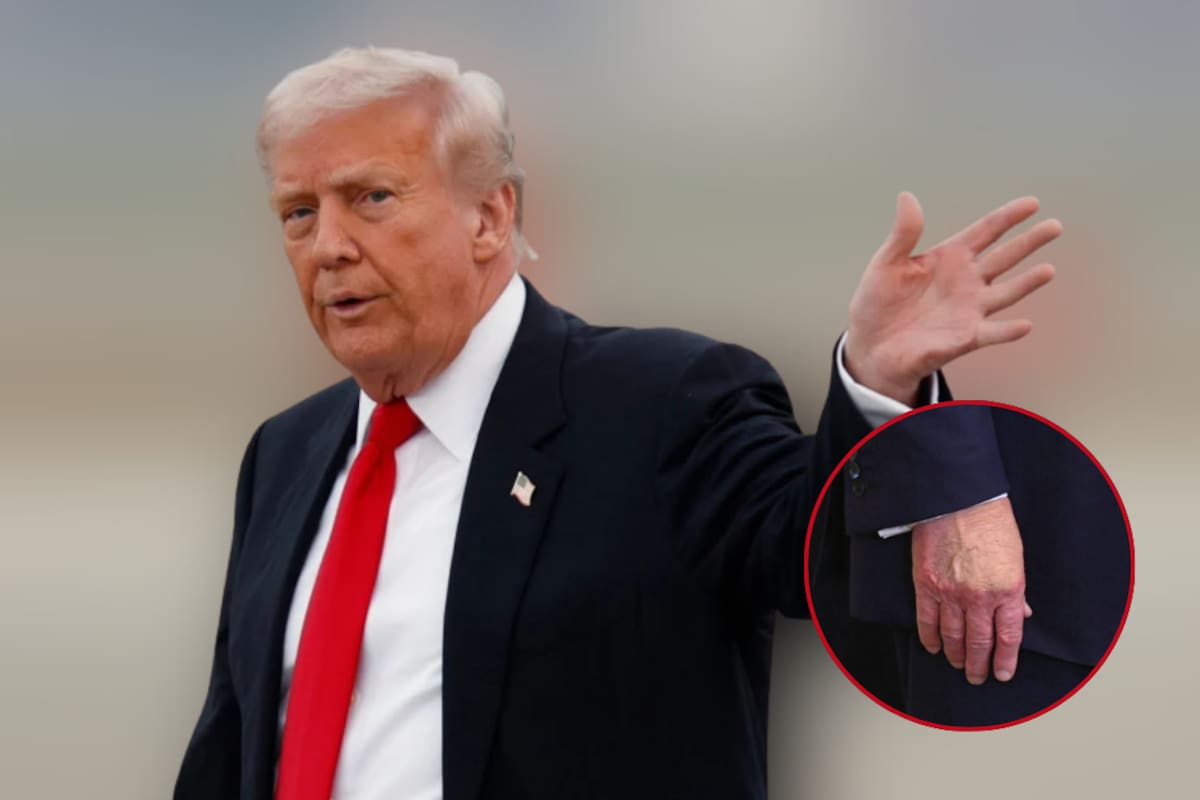 ¿Qué tiene Donald Trump en la mano? La mancha que generó dudas sobre su salud durante su discurso del Estado de la Unión