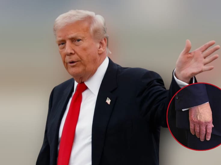 ¿Qué tiene Donald Trump en la mano? La mancha que generó dudas sobre su salud durante su discurso del Estado de la Unión