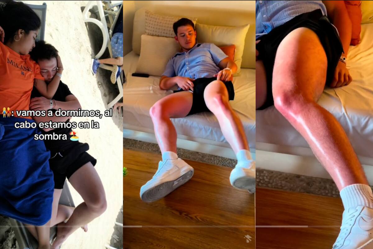 Pareja se confía de la sombra y se quedan dormidos en la playa: estas fueron las consecuencias