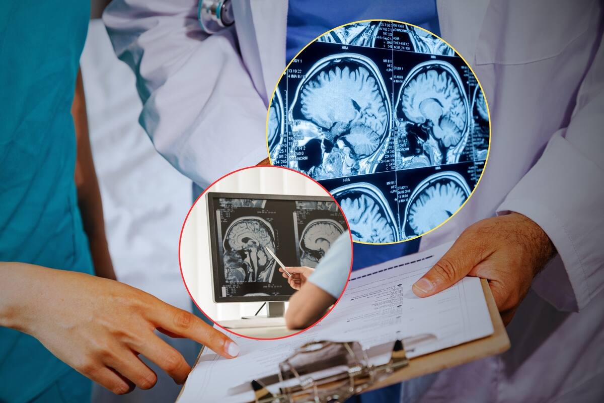 Cinco enfermeras de la misma unidad de maternidad de un hospital desarrollaron tumores cerebrales al mismo tiempo; investigan posible contaminación en el centro de salud de EEUU