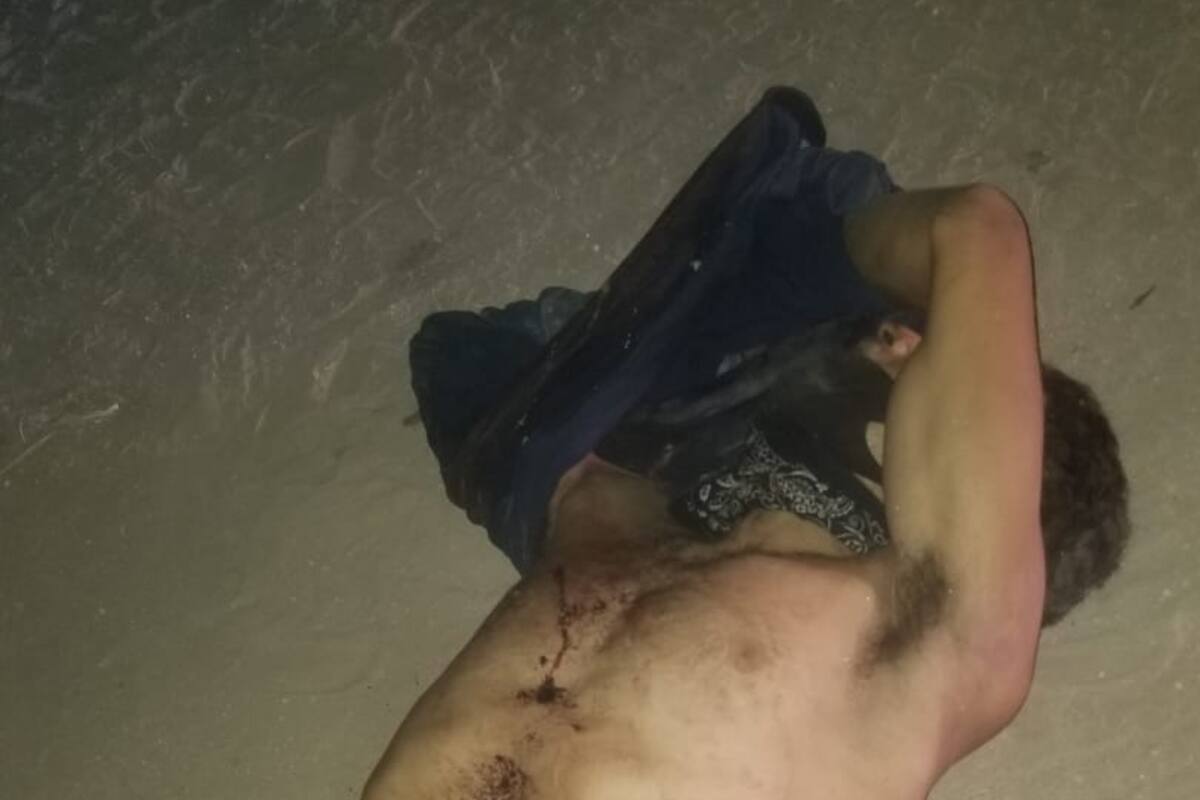 Matan a balazos a hombre en la Abasolo