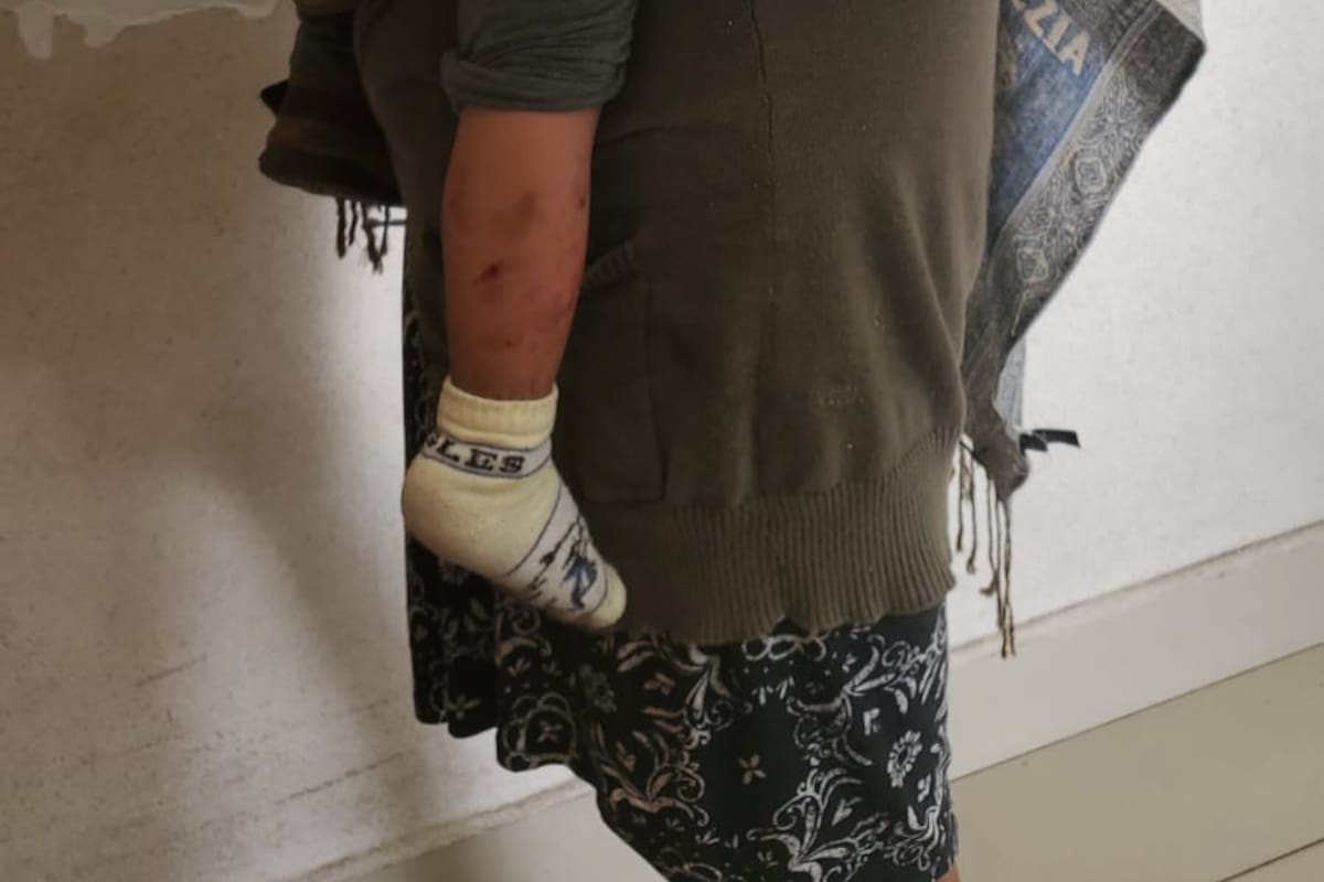 Rescatan a niño de 2 años en presunto caso de maltrato y omisión de cuidados en Libramiento Cuauhtémoc Sur