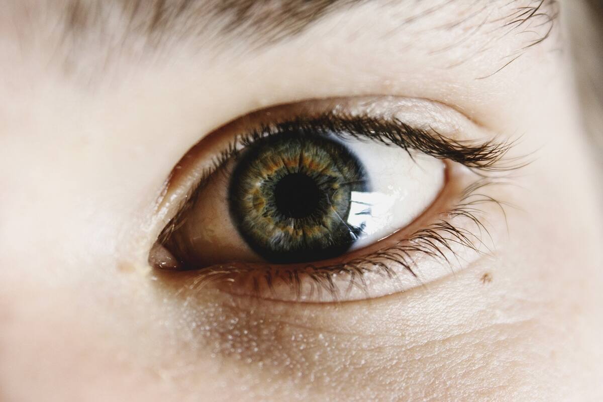 La conjuntivitis podría ser un síntoma de sospecha del Covid-19, según la Academia Estadounidense de Oftalmología