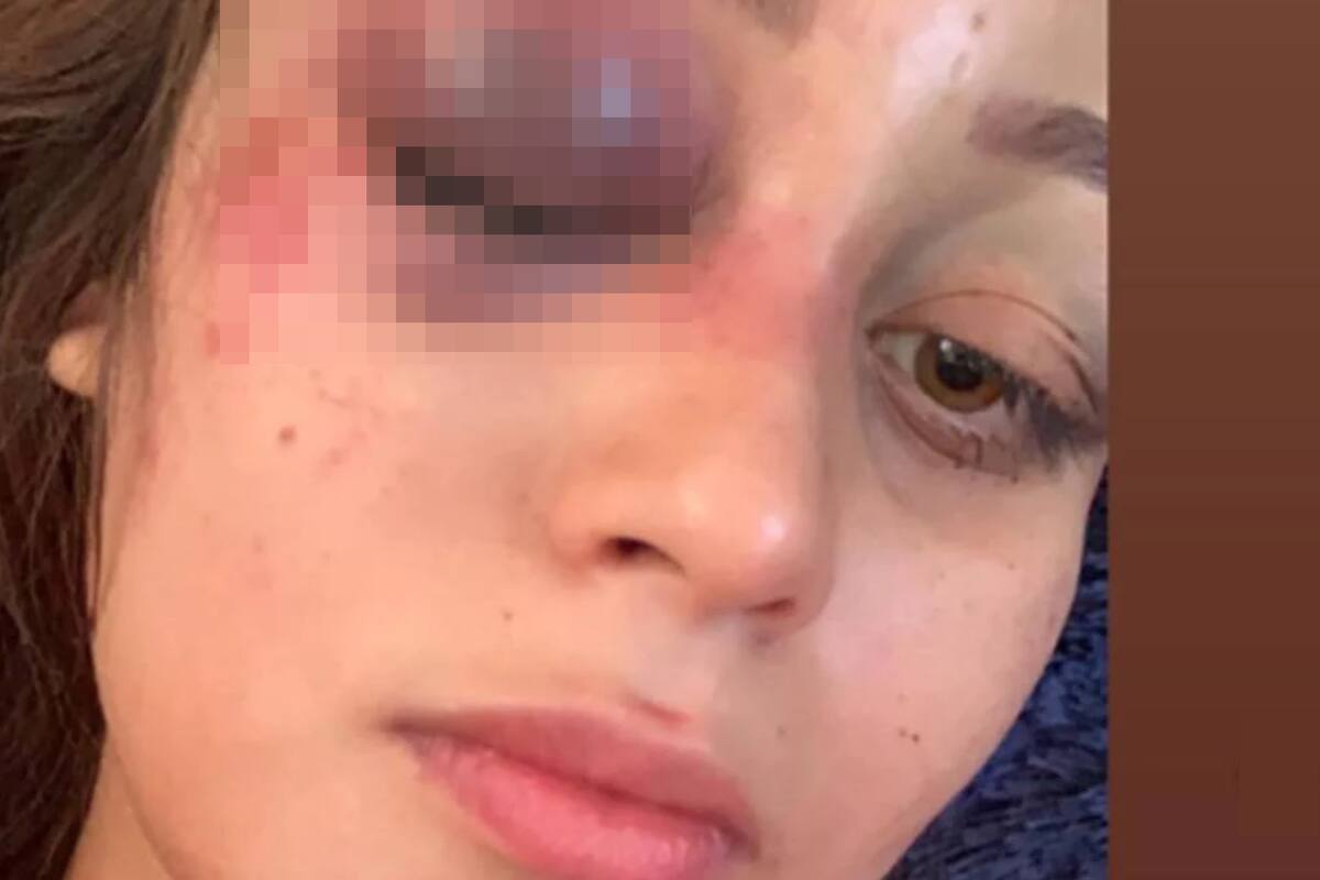 Sam Barrios: "Si no escapaba, quizás no estuviera viva", narra influencer cruda experiencia con su ex