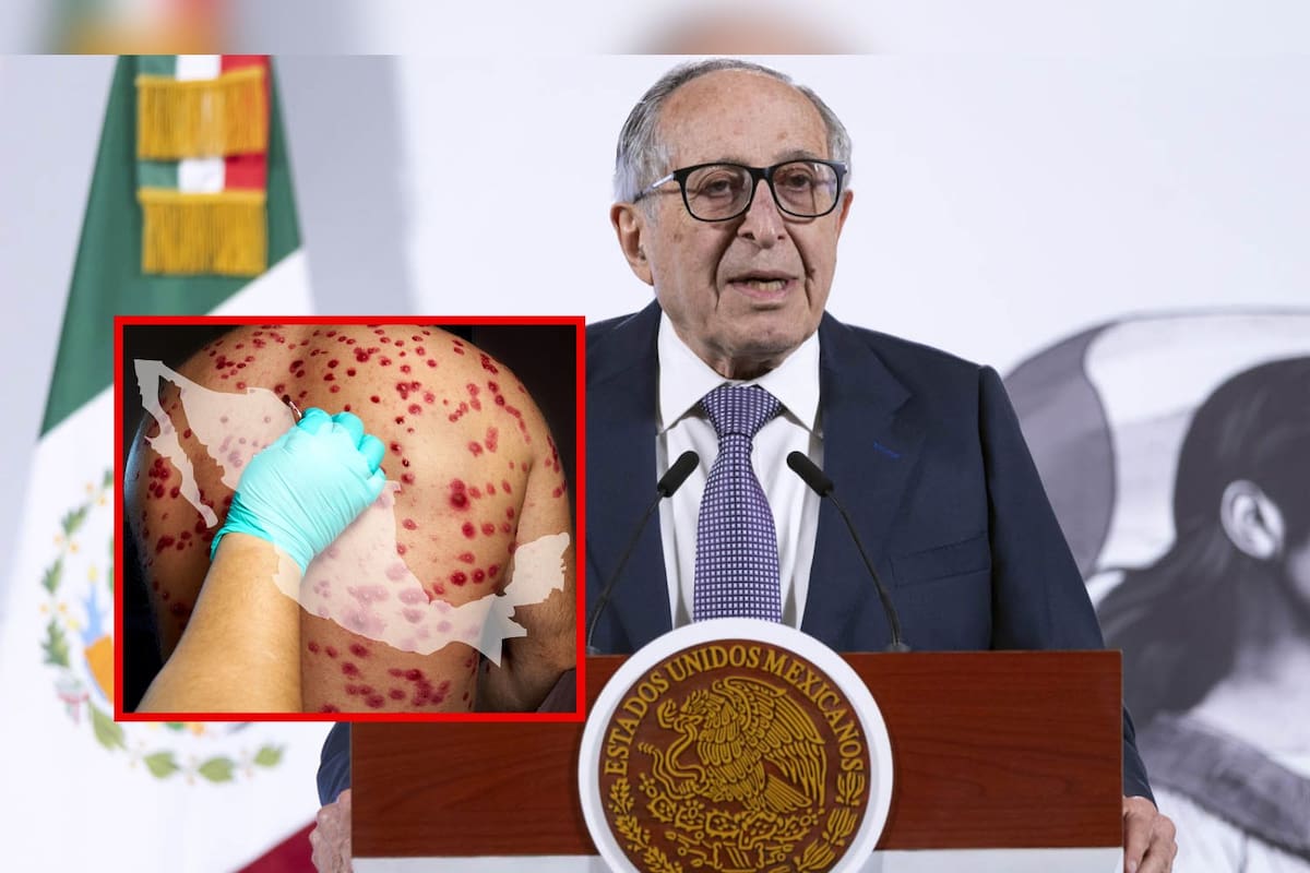 Sarampión en México: más de 4 mil casos y 17 muertes, alerta la Secretaría de Salud