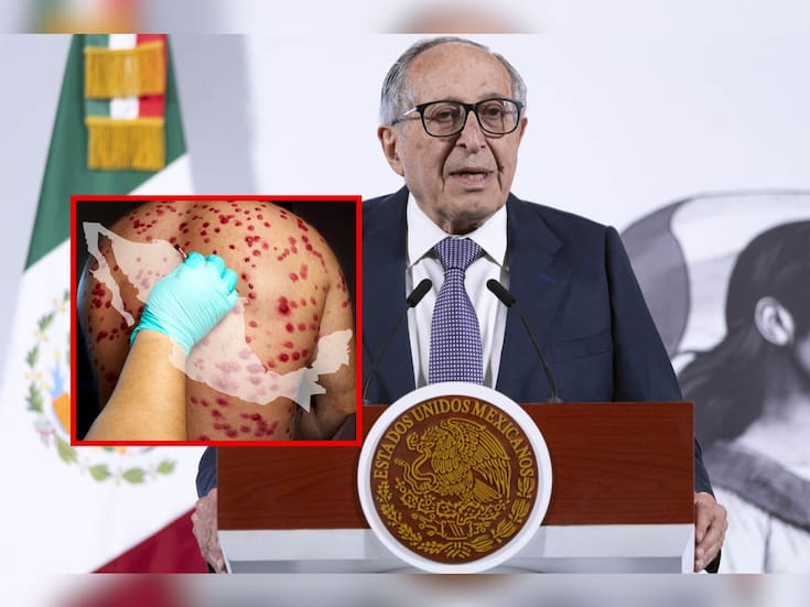 Salud reporta 87% de vacunación contra sarampión, “pero necesitamos llegar al 95%”, dice Kershenobich