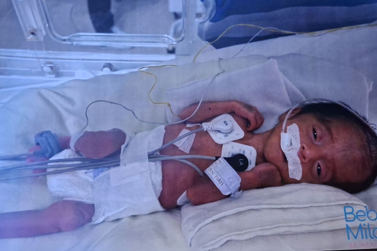 Celebran que Derek sobrevivió a un nacimiento prematuro