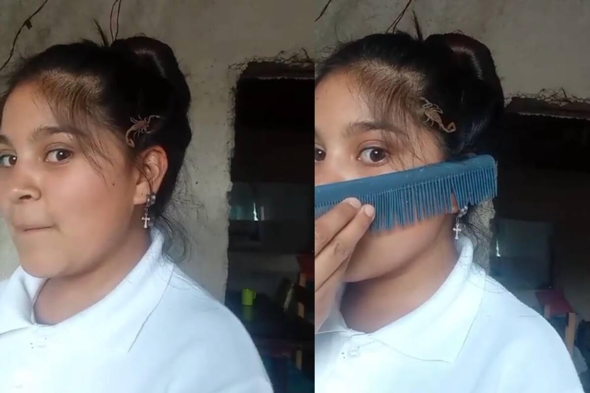 Niña impacta las redes sociales por tomarse un video con un alacrán en la cabeza | TikTok