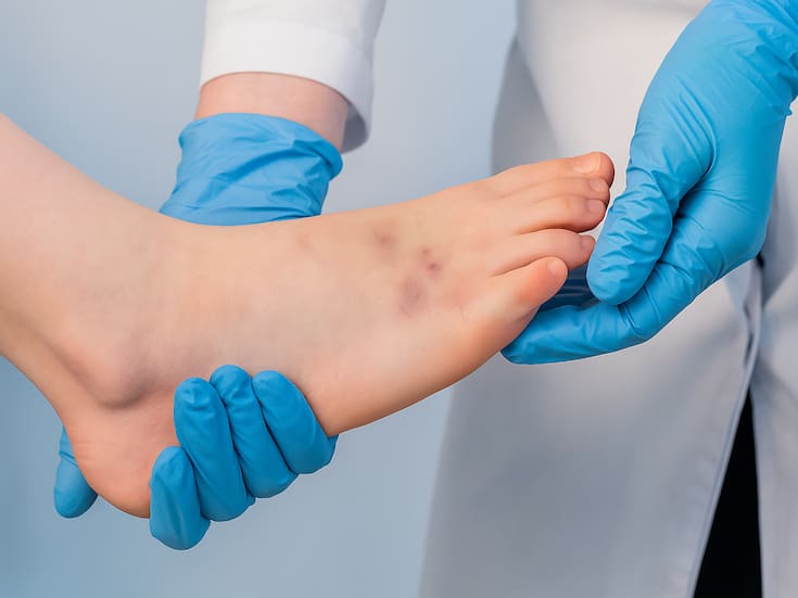 Suspenden clases por virus de Coxsackie