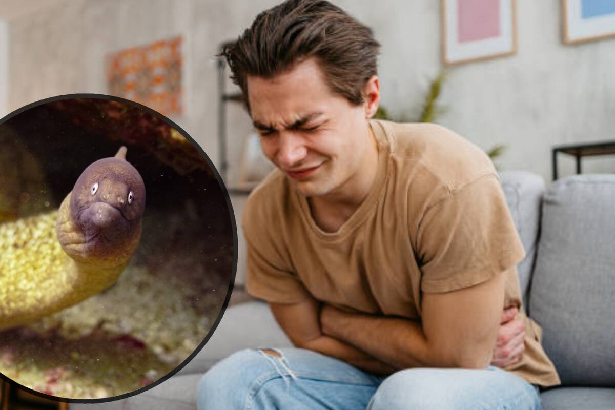 Médicos descubren anguila de 30 cm viva en abdomen de un hombre; se introdujo por su recto