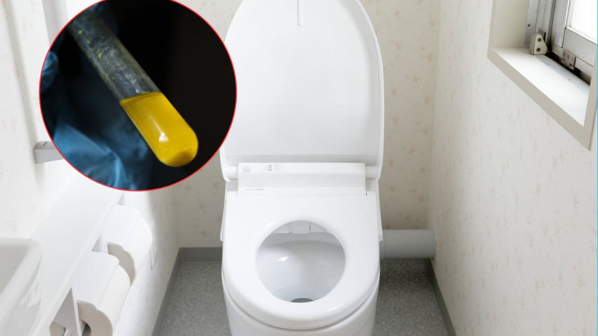 Olores inusuales en la orina pueden indicar infecciones urinarias o alteraciones metabólicas, advierten especialistas