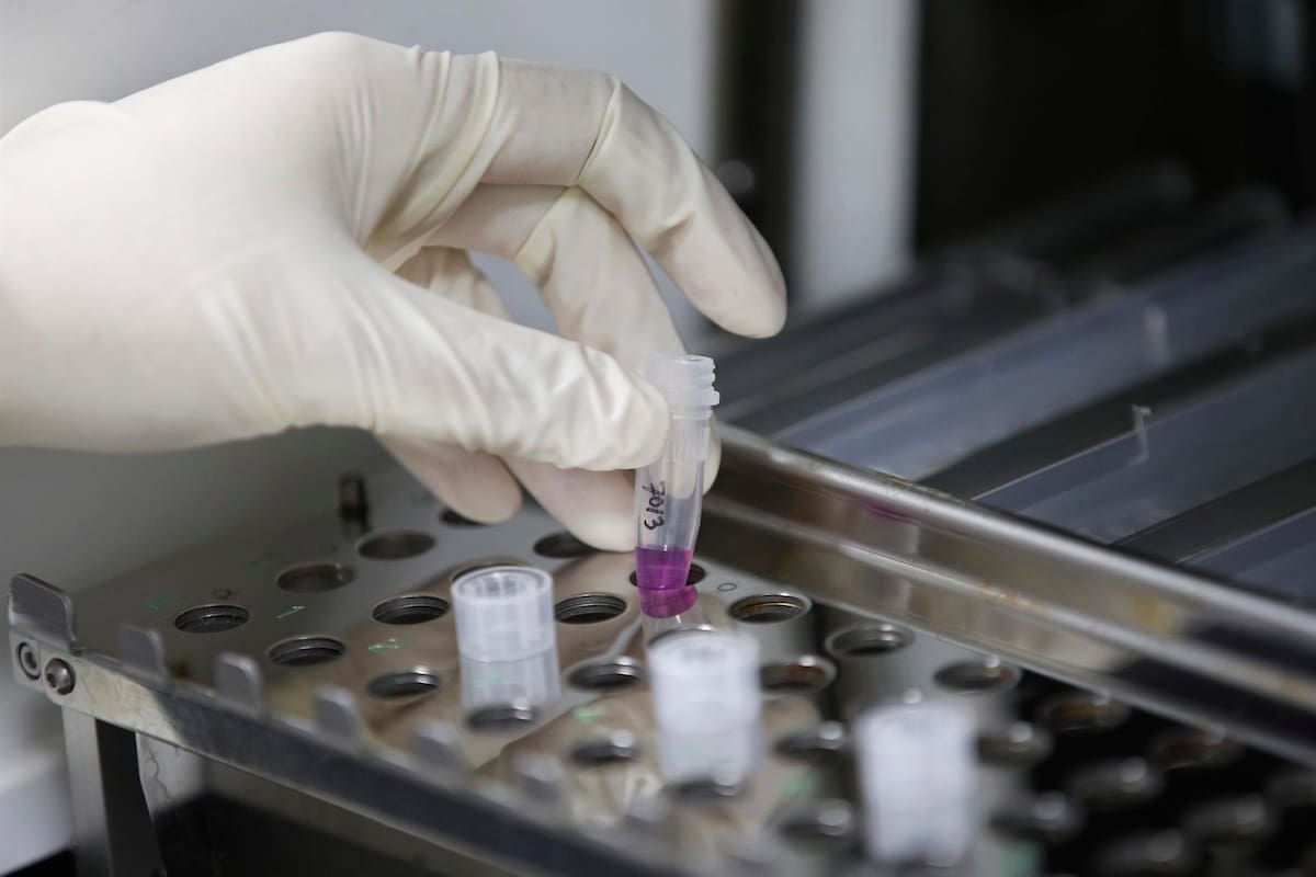 Nuevo test avanza un año la detección de cáncer de endometrio