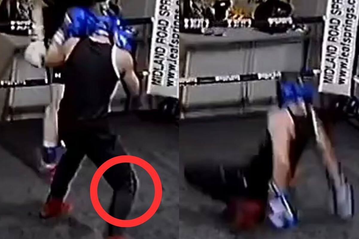 VIDEO: Joven boxeador se rompe la pierna en entrenamiento, rara enfermedad hizo que se la amputaran