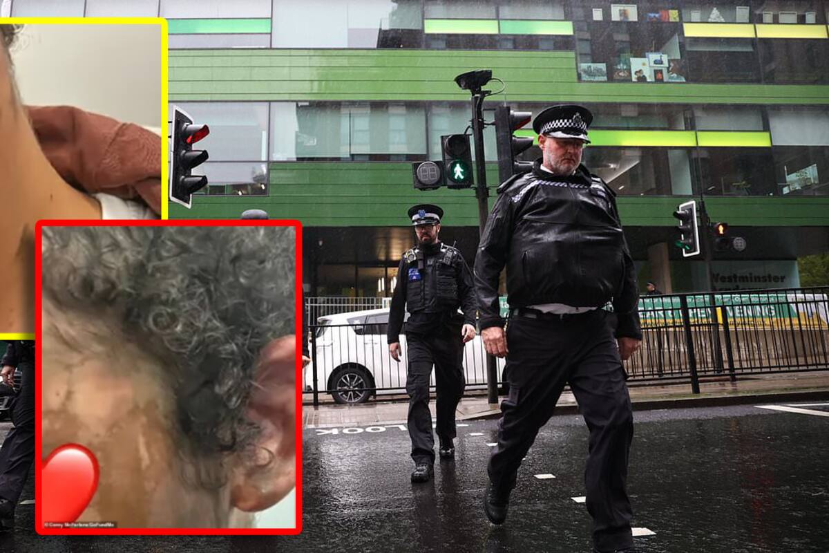 Niña de 14 años quedará con cicatrices en el rostro tras brutal ataque con ácido afuera de su escuela en Londres: “Mi hija está traumatizada”