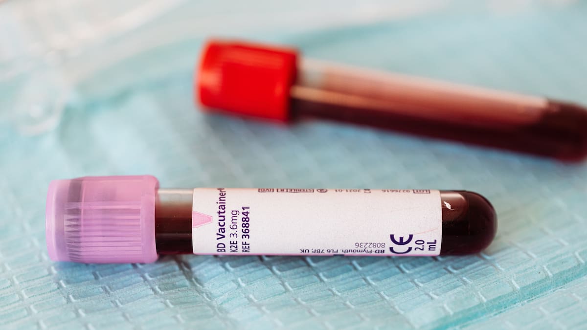 Un equipo de científicos en Suiza creó por primera vez una médula ósea humana en miniatura capaz de producir sangre durante semanas/Foto: Canva