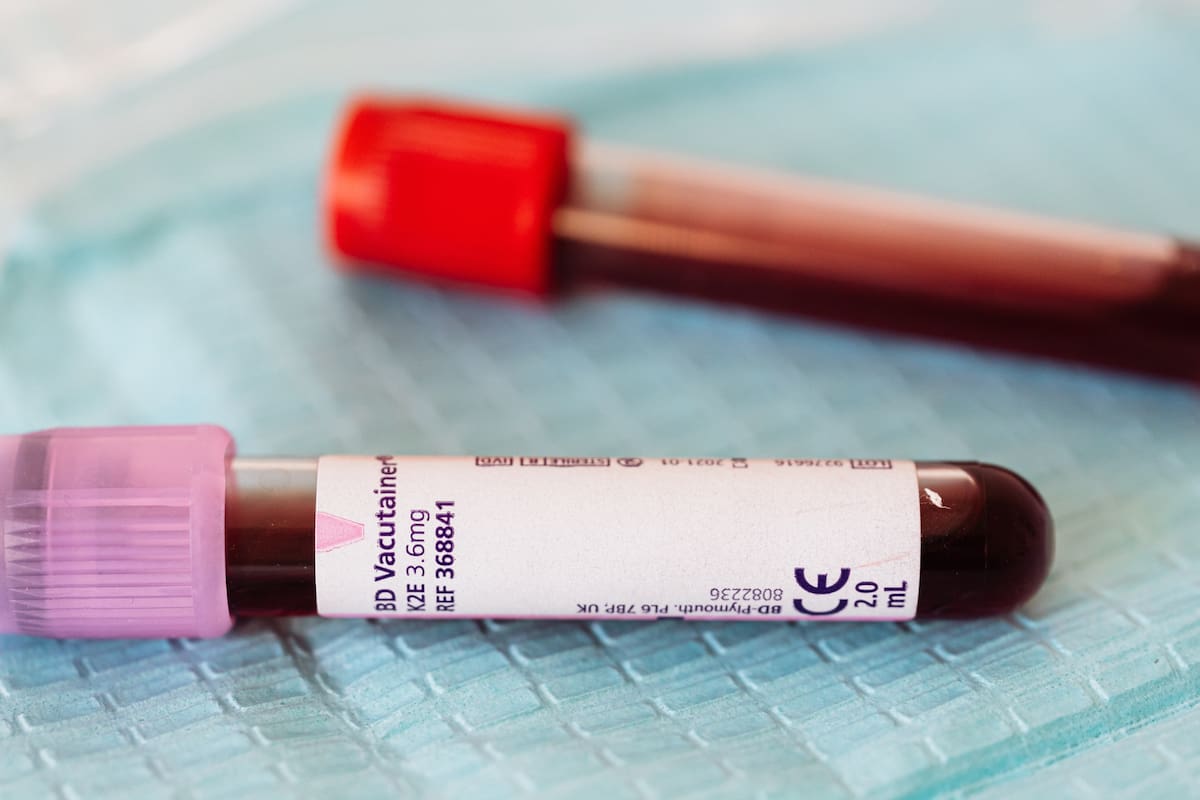 Científicos suizos crean la primera médula ósea humana en miniatura capaz de producir sangre