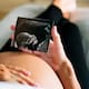 Edad reproductiva y cambios sociales elevan demanda de tratamientos de fertilidad, señalan especialistas