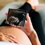 Edad reproductiva y cambios sociales elevan demanda de tratamientos de fertilidad, señalan especialistas