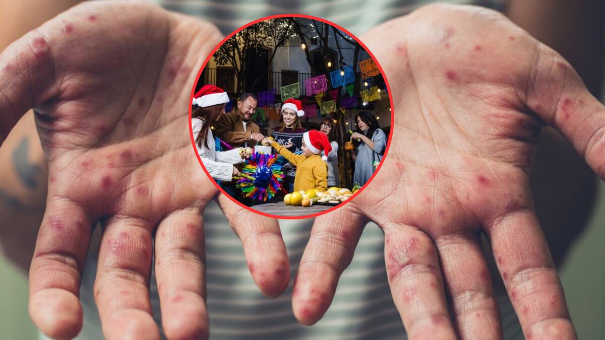 Ante el aumento de casos de sarampión en Chiapas, la Secretaría de Salud emite oficio que exhorta a cancelar eventos masivos, alerta sobre la alta capacidad de contagio del virus y busca frenar la transmisión durante el invierno