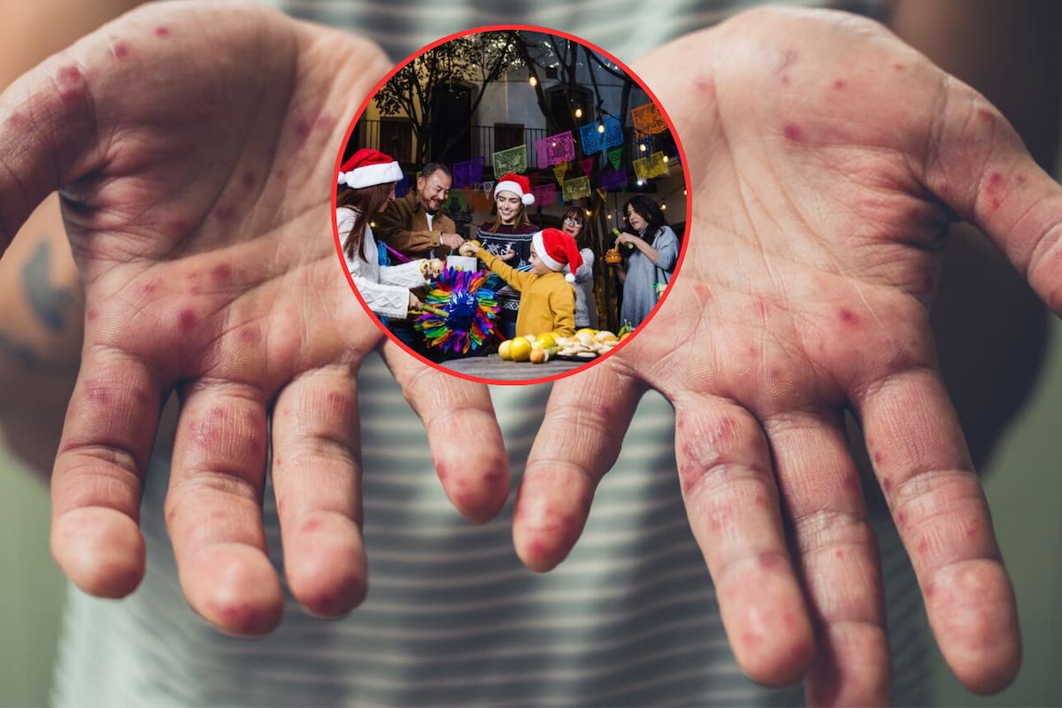 Ante el aumento de casos de sarampión en Chiapas, la Secretaría de Salud emite oficio que exhorta a cancelar eventos masivos, alerta sobre la alta capacidad de contagio del virus y busca frenar la transmisión durante el invierno