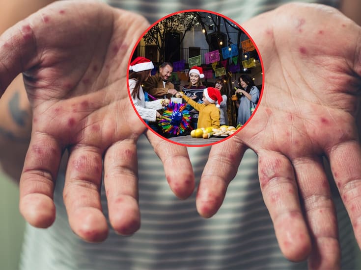 Ante el aumento de casos de sarampión en Chiapas, la Secretaría de Salud emite oficio que exhorta a cancelar eventos masivos, alerta sobre la alta capacidad de contagio del virus y busca frenar la transmisión durante el invierno