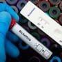 Suman 15 fallecidos por rickettsia en BC durante 2026