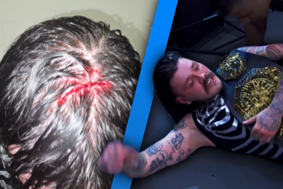 ¿Qué le pasó? Dominik Mysterio sufrió de conmoción cerebral en la WWE