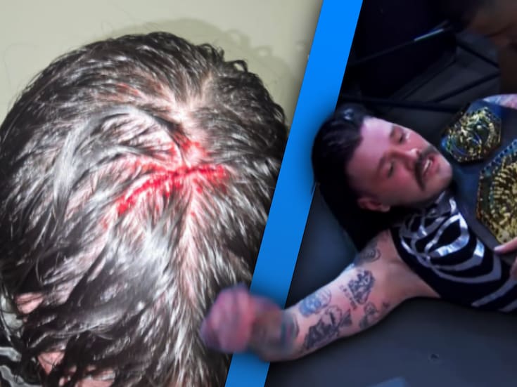 ¿Qué le pasó? Dominik Mysterio sufrió de conmoción cerebral en la WWE