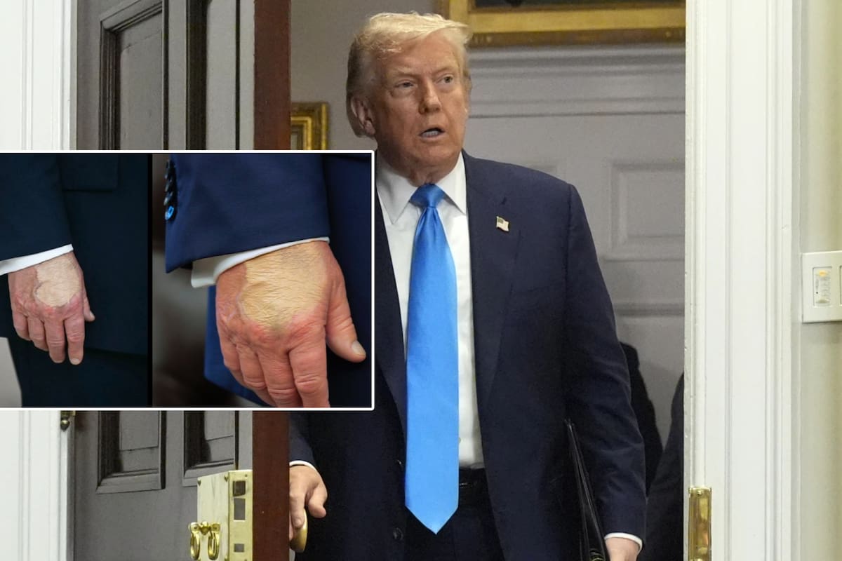 ¿Dónde está Trump y qué le pasa en sus manos? Alarma que desaparezca sin programar eventos públicos para este fin de semana