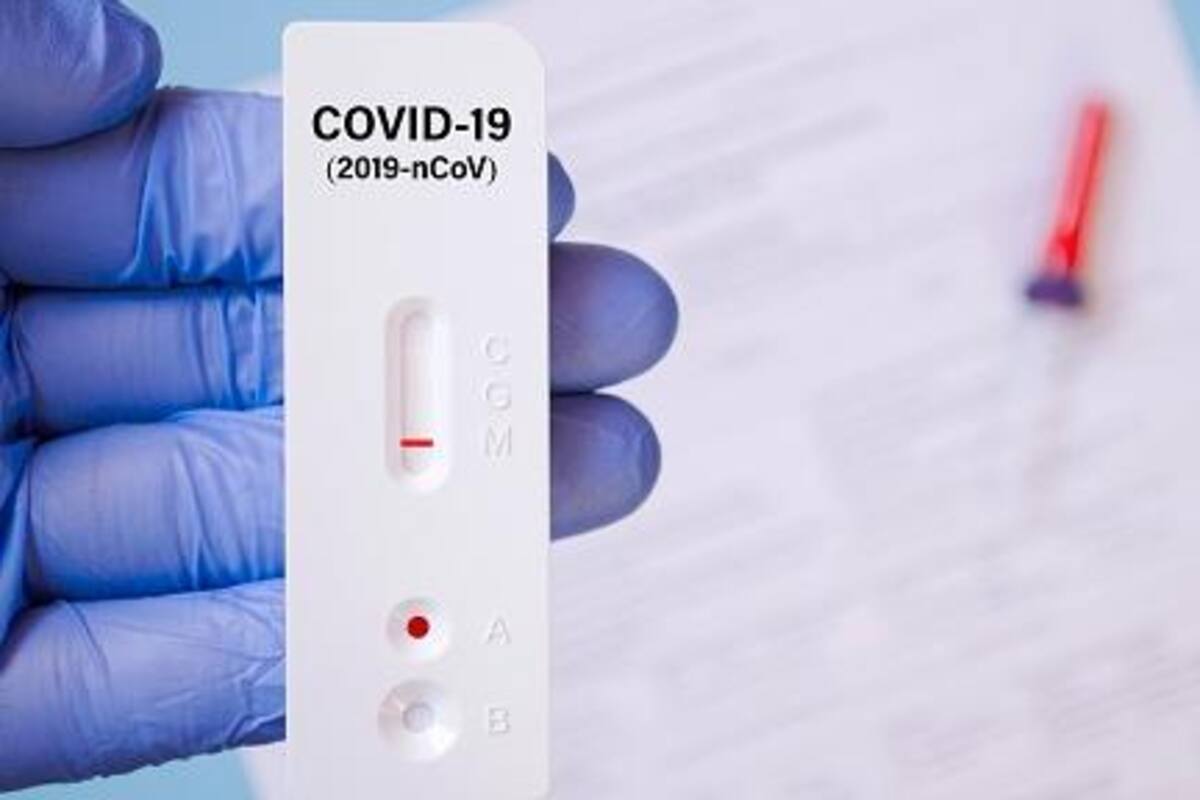 Covid-19 en México: Qué es la prueba antigénica, que llegaría próximamente al País
