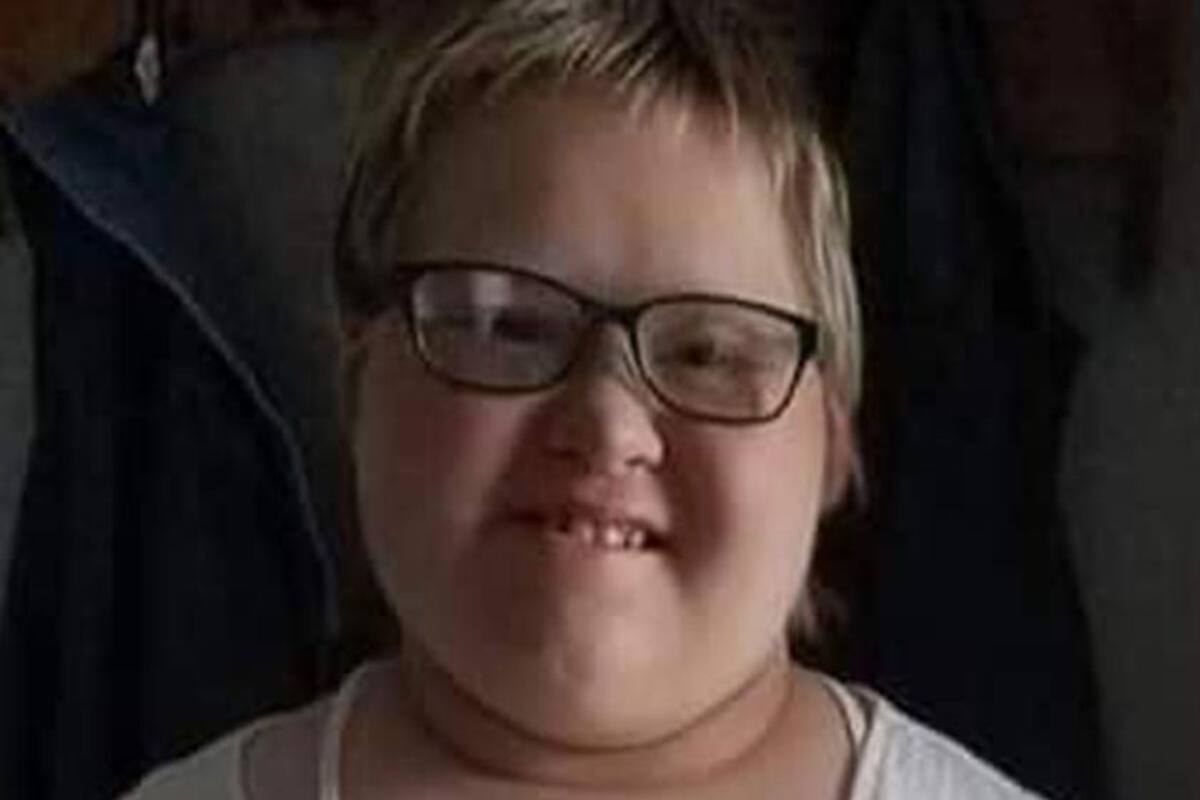 Adolescente con síndrome de Down sobrevive al cáncer pero muere de Covid-19