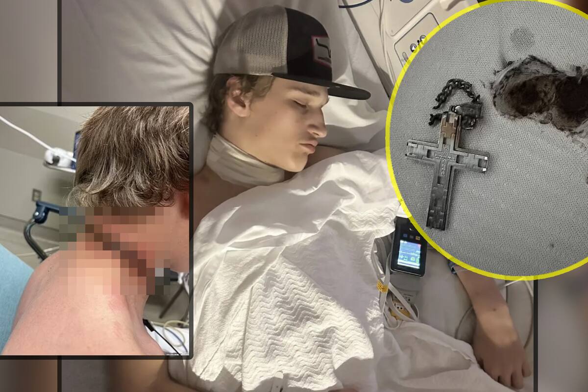 Crucifijo provoca que un adolescente de 16 años casi muera en un extraño accidente por electrocutación