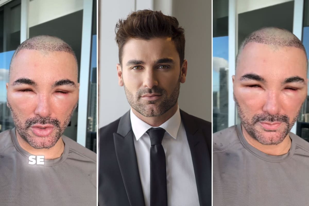 Actor Mauricio Mejía sorprende con drástico cambio en su rostro